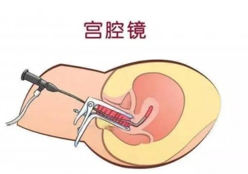 北京供卵试管：如何确定试管移植成功后的孕周？有哪些方法可以进行计算？